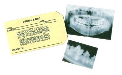 Røntgenbilleder - Tandsæt